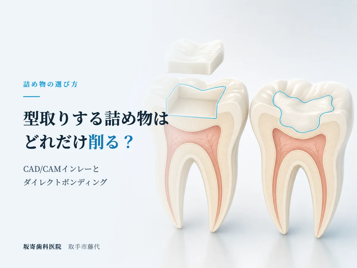 CAD/CAMインレーはどれだけ削る？直接詰める治療との違いと選び方