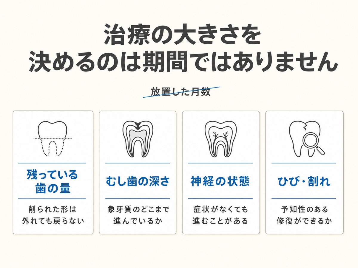 詰め物が取れた歯の治療内容を決める4つの判断軸を示した図。放置した月数ではなく、残っている歯の量・むし歯の深さ・神経の状態・ひびや割れの有無で決まることを、歯の線画アイコンとともに整理している。
